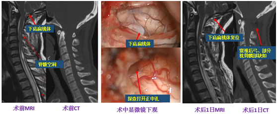 21点游戏规则