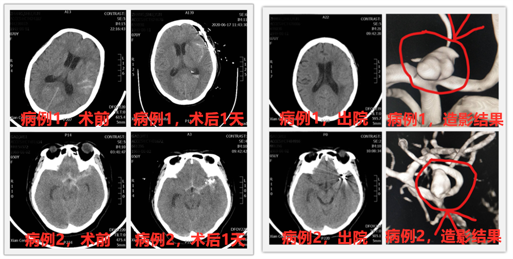 21点游戏规则