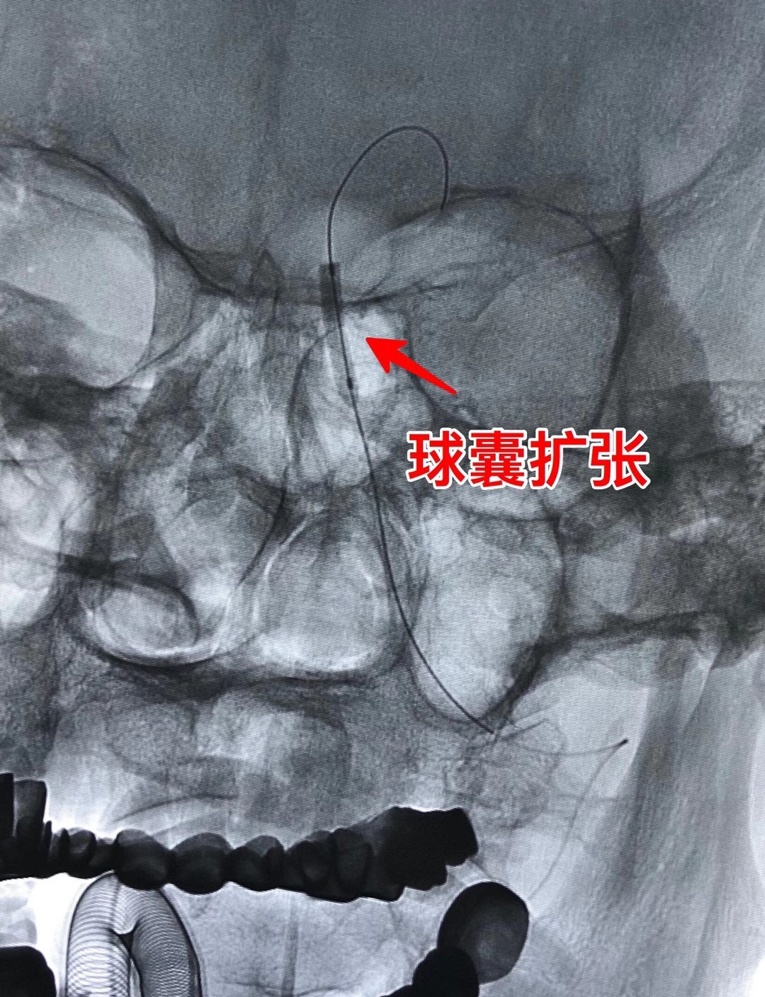 21点游戏规则