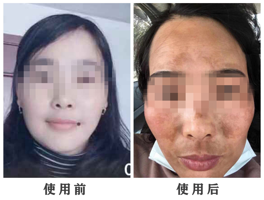 21点游戏规则
