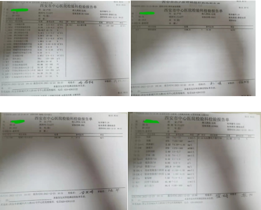 21点游戏规则
