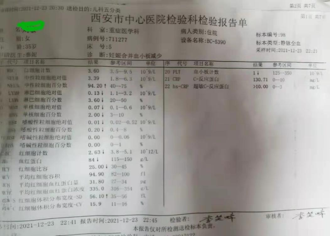 21点游戏规则