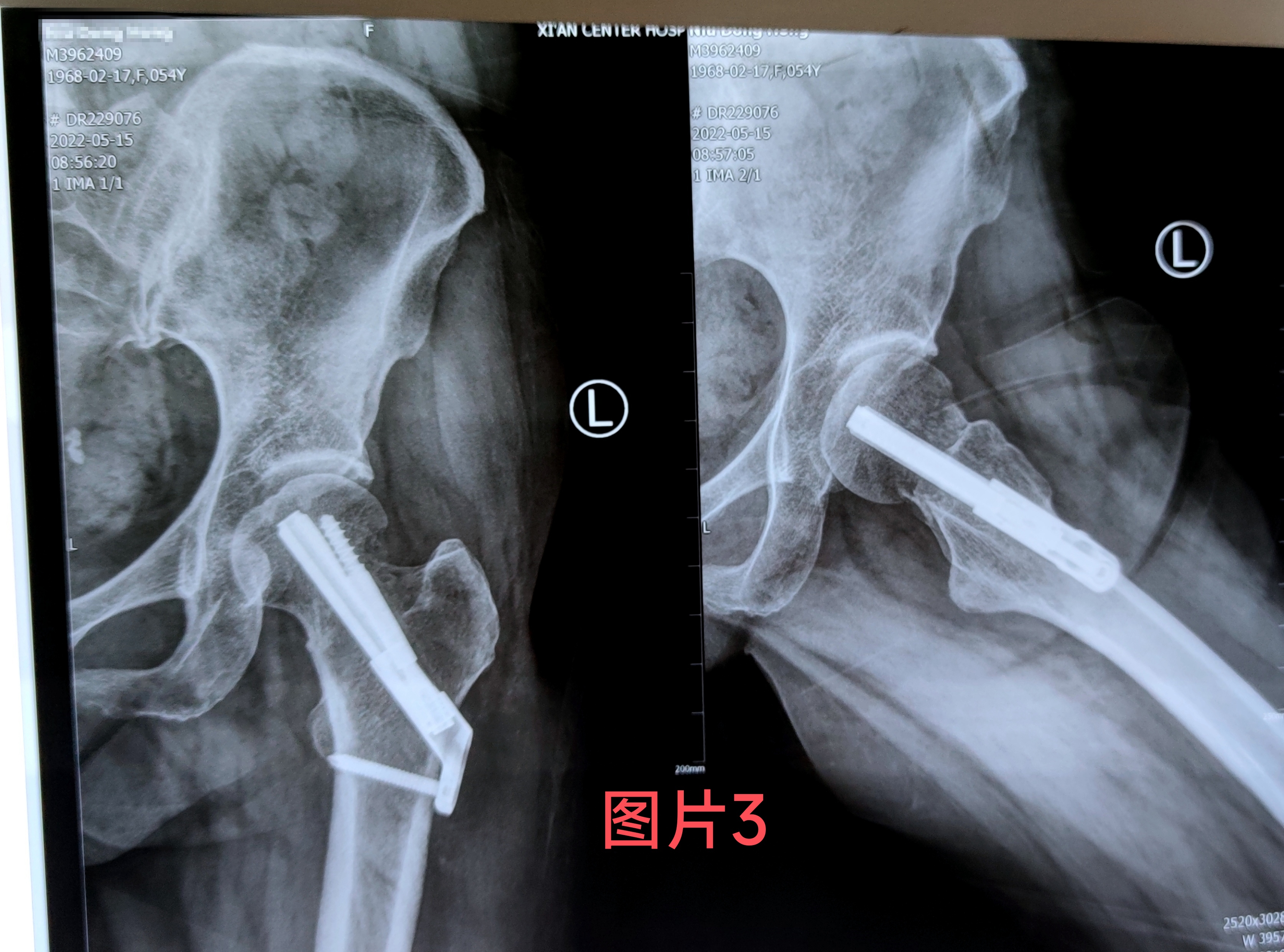 21点游戏规则