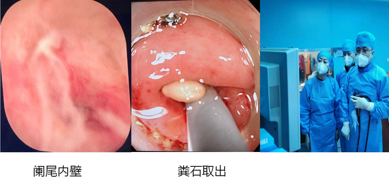 21点游戏规则